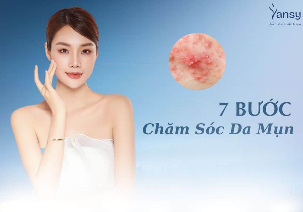 Cách chăm sóc da mụn