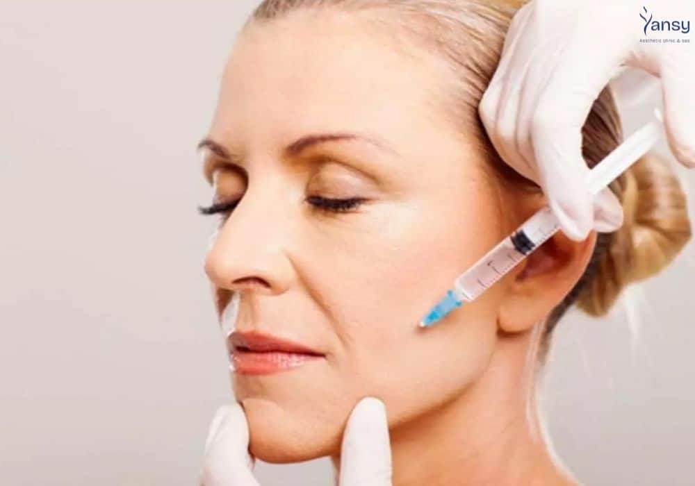 các cách làm đầy rãnh cười