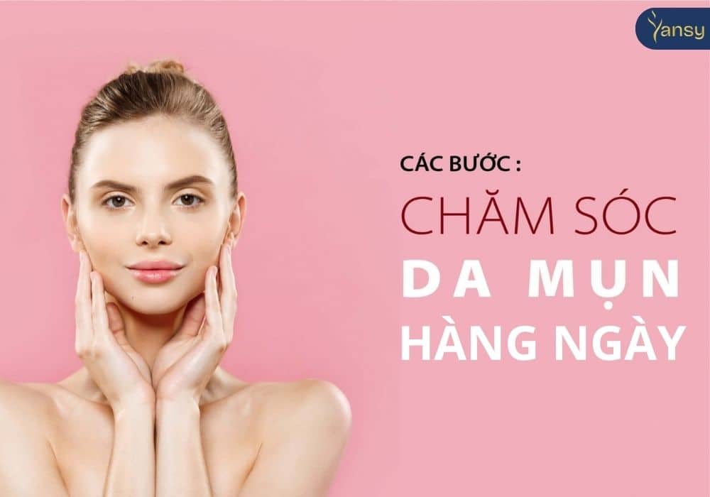các cách chăm sóc da mụn hàng ngày