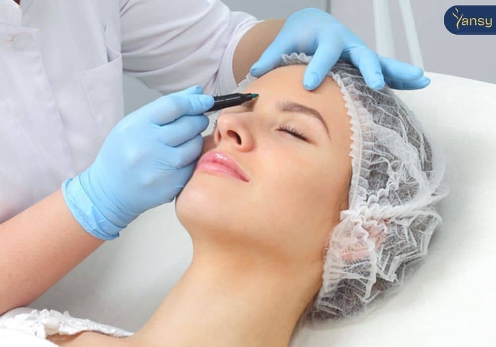 Cách làm đầy trán hiệu quả nhất hiện nay