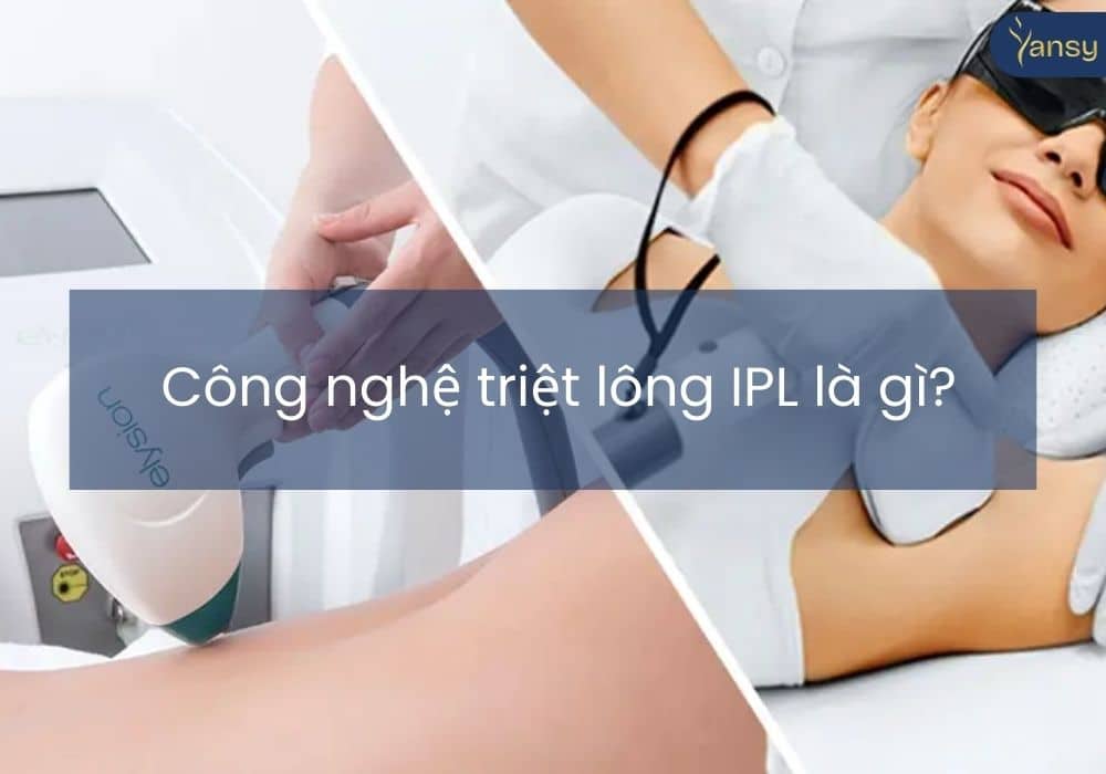 Công nghệ triệt lông IPL là gì?