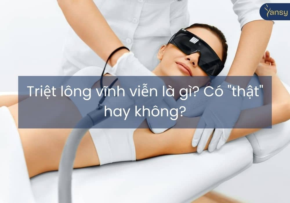 Triệt lông vĩnh viễn là gì? Có "thật" hay không?