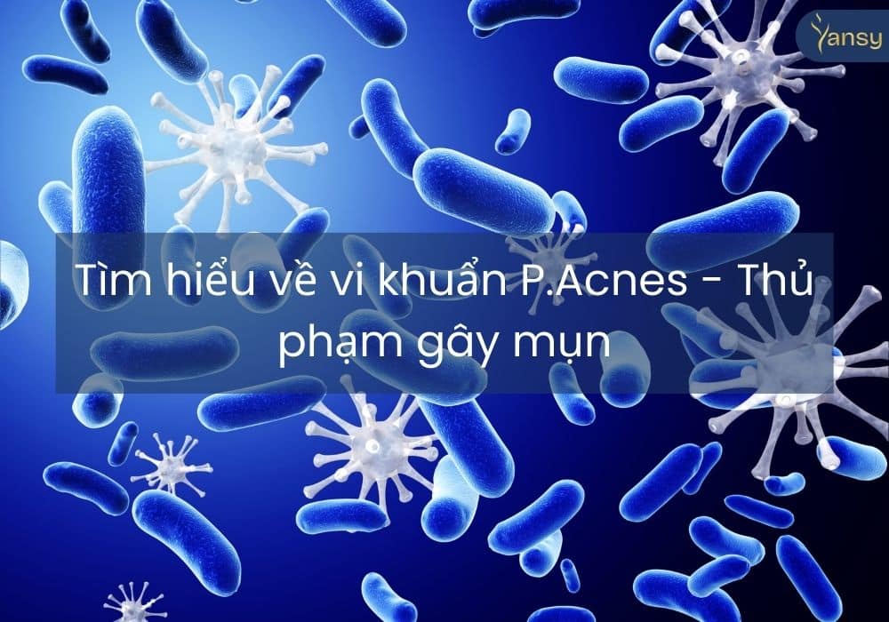 Tìm hiểu về vi khuẩn P.Acnes - Thủ phạm gây mụn