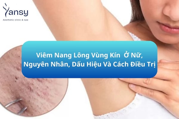 Viêm nang lông nách