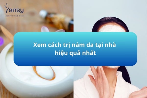 Cách trị nám da tại nhà