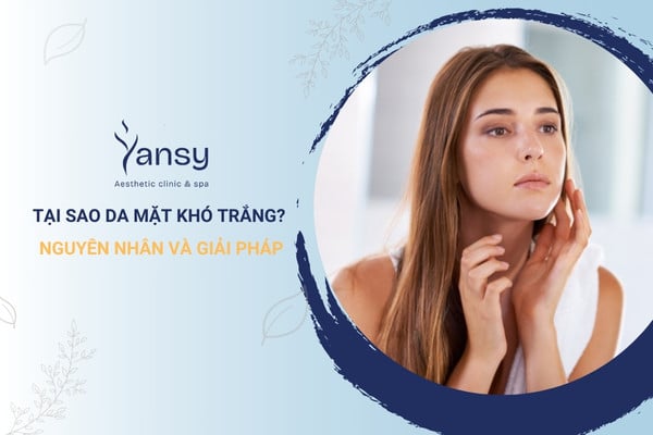 Tại sao da mặt khó trắng? Giải đáp cùng Yansy Clinic ngay thôi