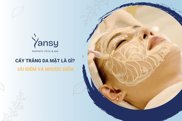 Cấy trắng da mặt là phương pháp gì