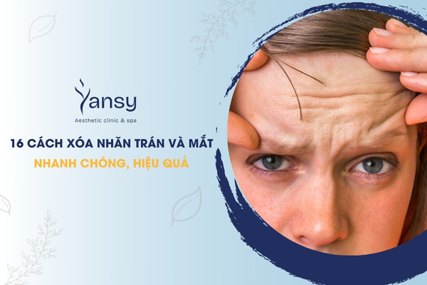 trẻ hóa xóa nhăn trán và mắt