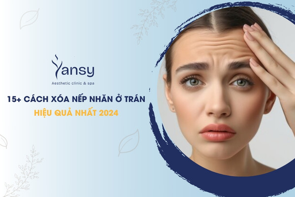 xóa nếp nhăn ở trán