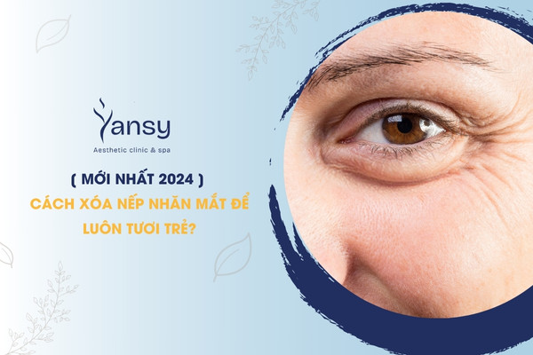 Xóa nếp nhăn mắt