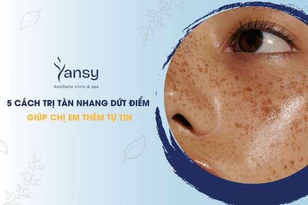 cách trị tàn nhang