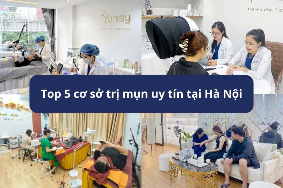 Cơ sở trị mụn