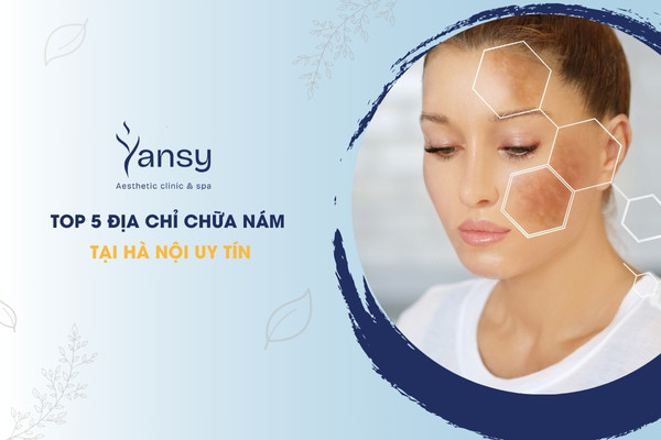 Địa chỉ chữa nám tại Hà Nội