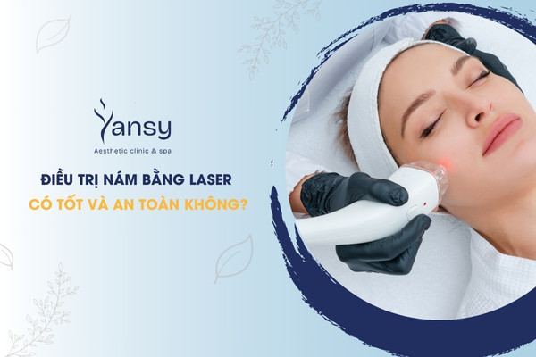 Điều trị nám bằng laser