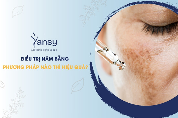 Điều trị nám