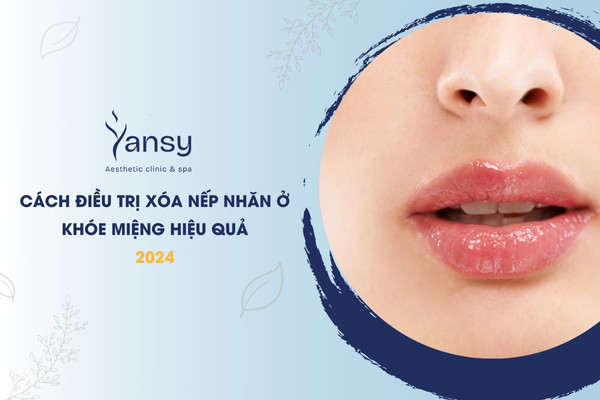 Xóa nếp nhăn ở khóe miệng