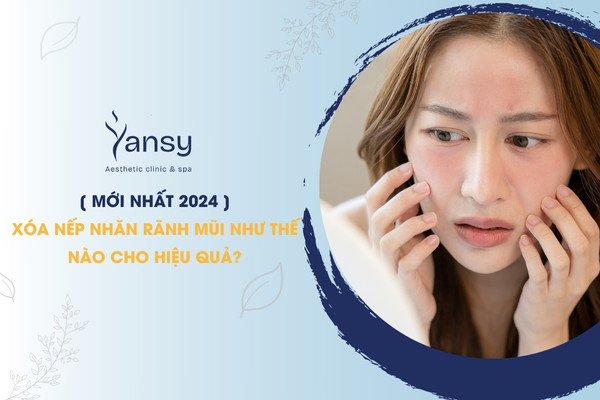 Xóa nếp nhăn rãnh mũi