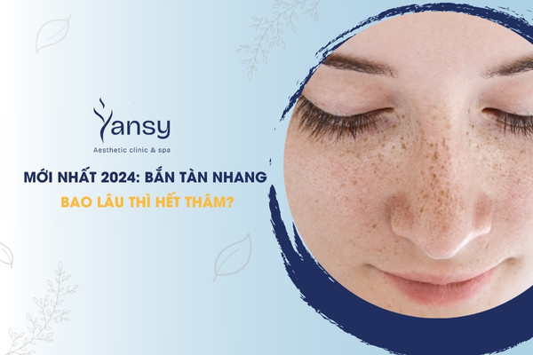 Bắn tàn nhang bao lâu thì hết thâm
