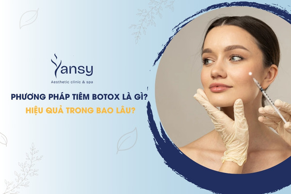 Botox là gì