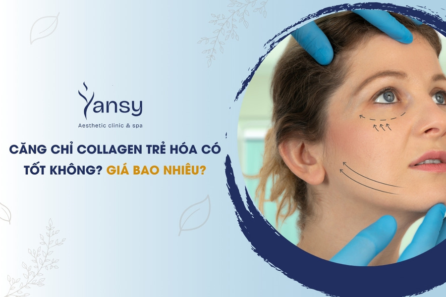 Ảnh đại diện: Căng chỉ collagen có an toàn không? Giá bao nhiêu