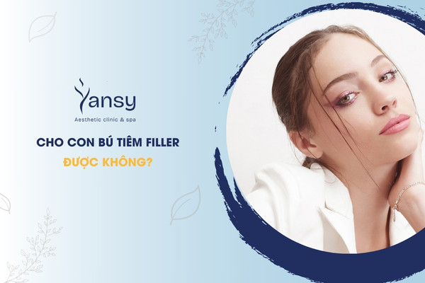 Cho con bú tiêm filler được không
