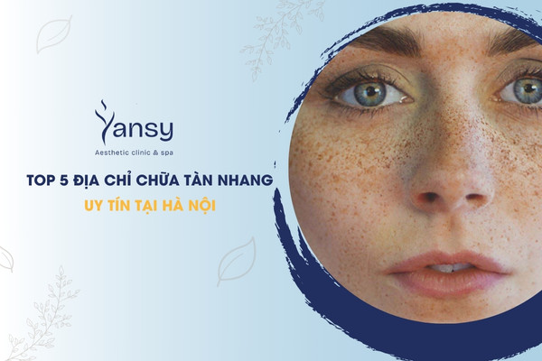 top 5 địa chỉ chữa tàn nhang uy tín hà nội