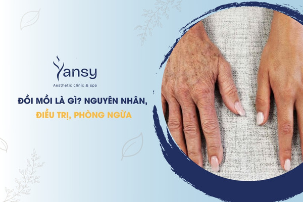 Đồi mồi là gì