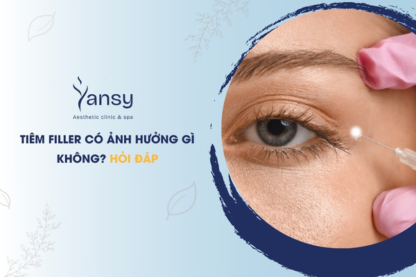 Tiêm Filler có ảnh hưởng gì không?