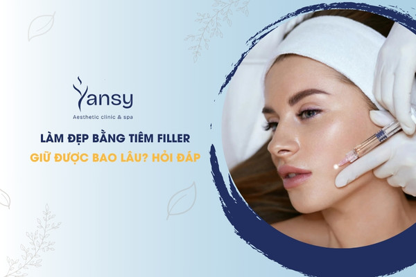 tiêm filler giữ được bao lâu
