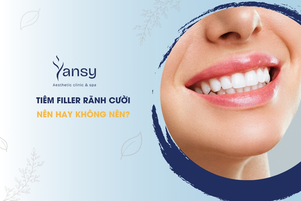 tiêm filler rãnh cười