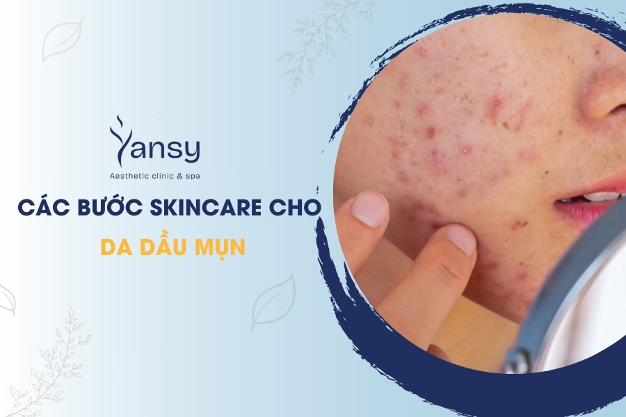 Các bước skincare cho da dầu mụn