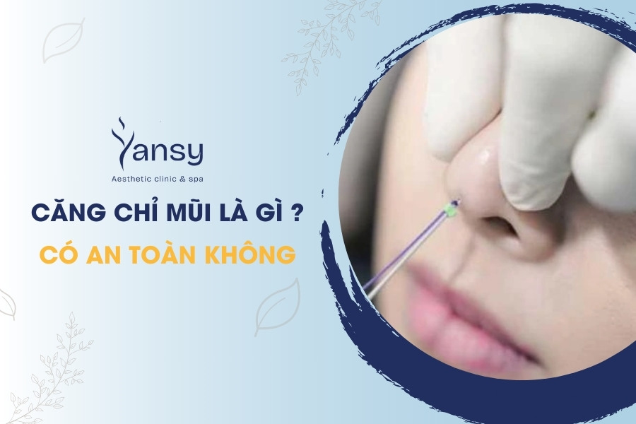 Căng chỉ mũi là gì
