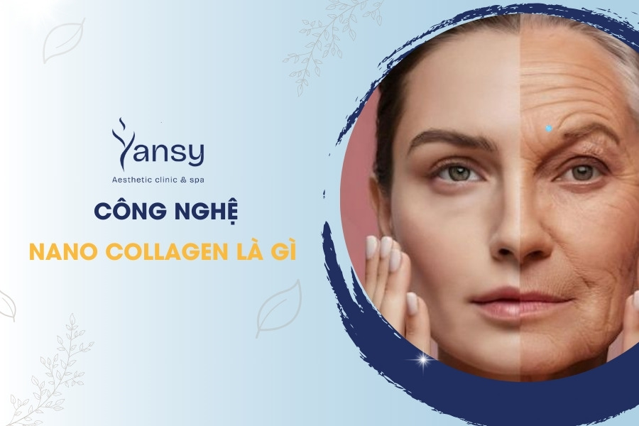 Công nghệ collagen nano là gì