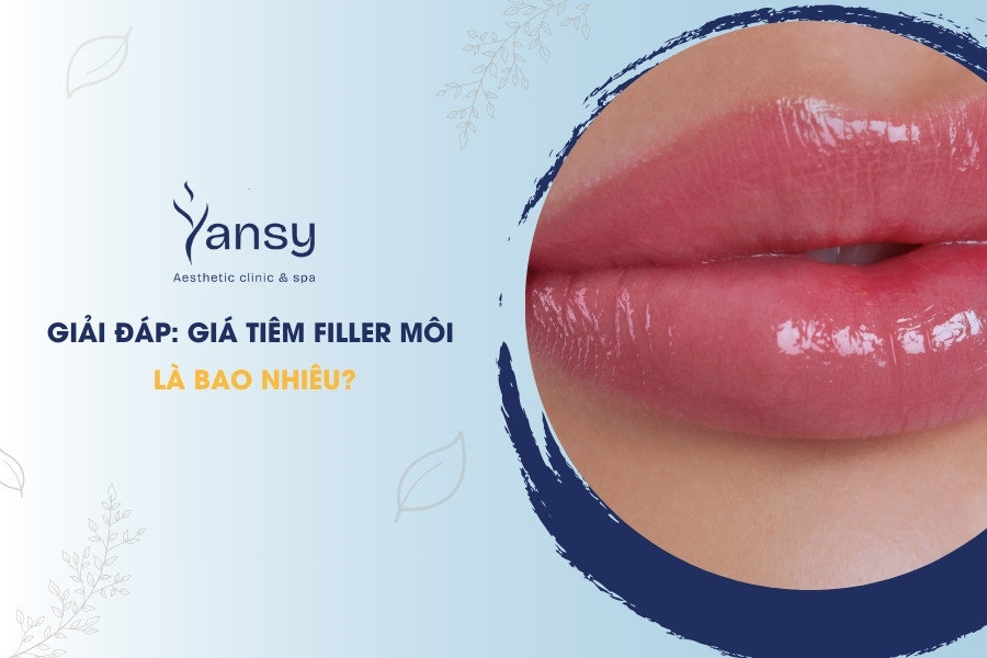 Giá tiêm filler môi là bao nhiêu?