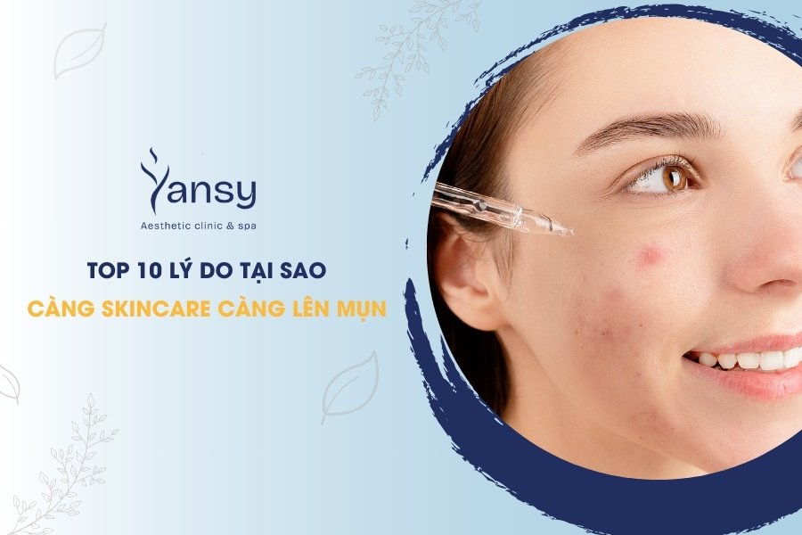 tại sao càng skincare càng lên mụn