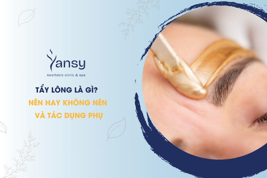 Tẩy lông là gì