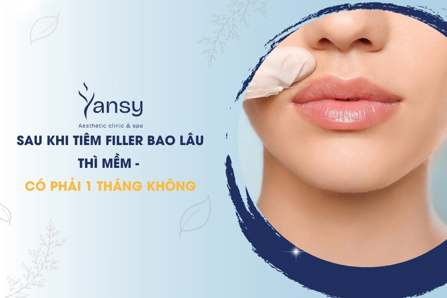 Sau khi tiêm filler bao lâu thì mềm - Có phải 1 tháng không