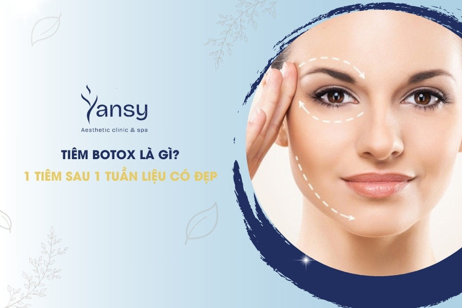 Tiêm Filler Có Hại Về Sau Không?