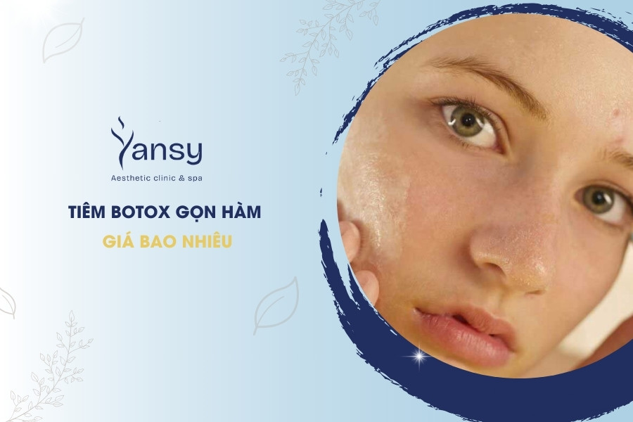 Tiêm botox gọn hàm giá bao nhiêu