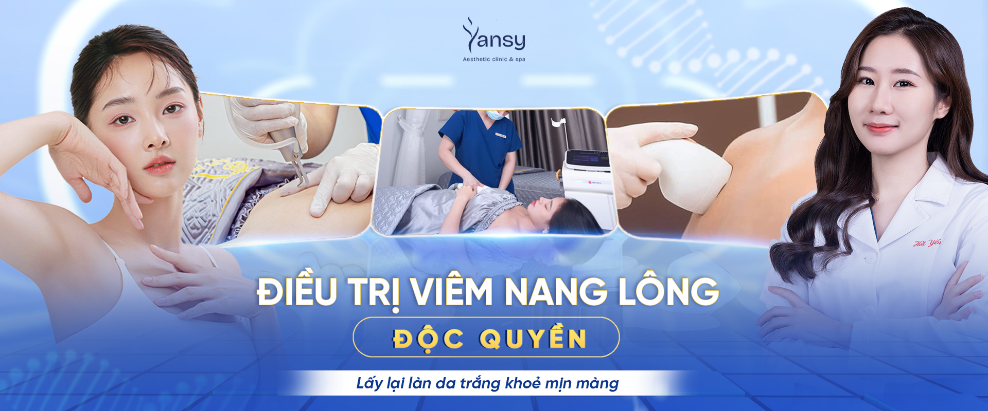 điều trị viêm nang lông dứt điểm