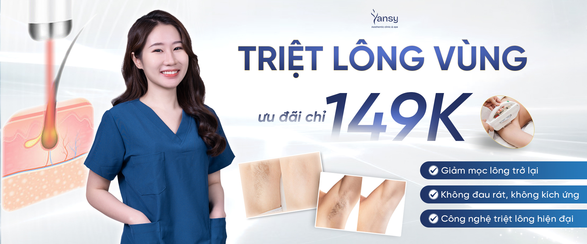 Triệt lông trắng da